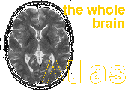 Brain Atlas