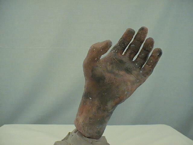 hand (front)